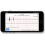 ProMedix Bratara fitness Tracker EKG PR-650, negru
