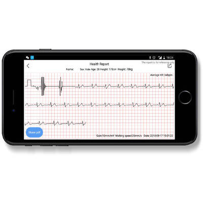 ProMedix Bratara fitness Tracker EKG PR-650, negru