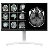 Monitor LG Clinical Review 27HJ712C-W 27 inch UHD IPS 14 ms 60 Hz DICOM